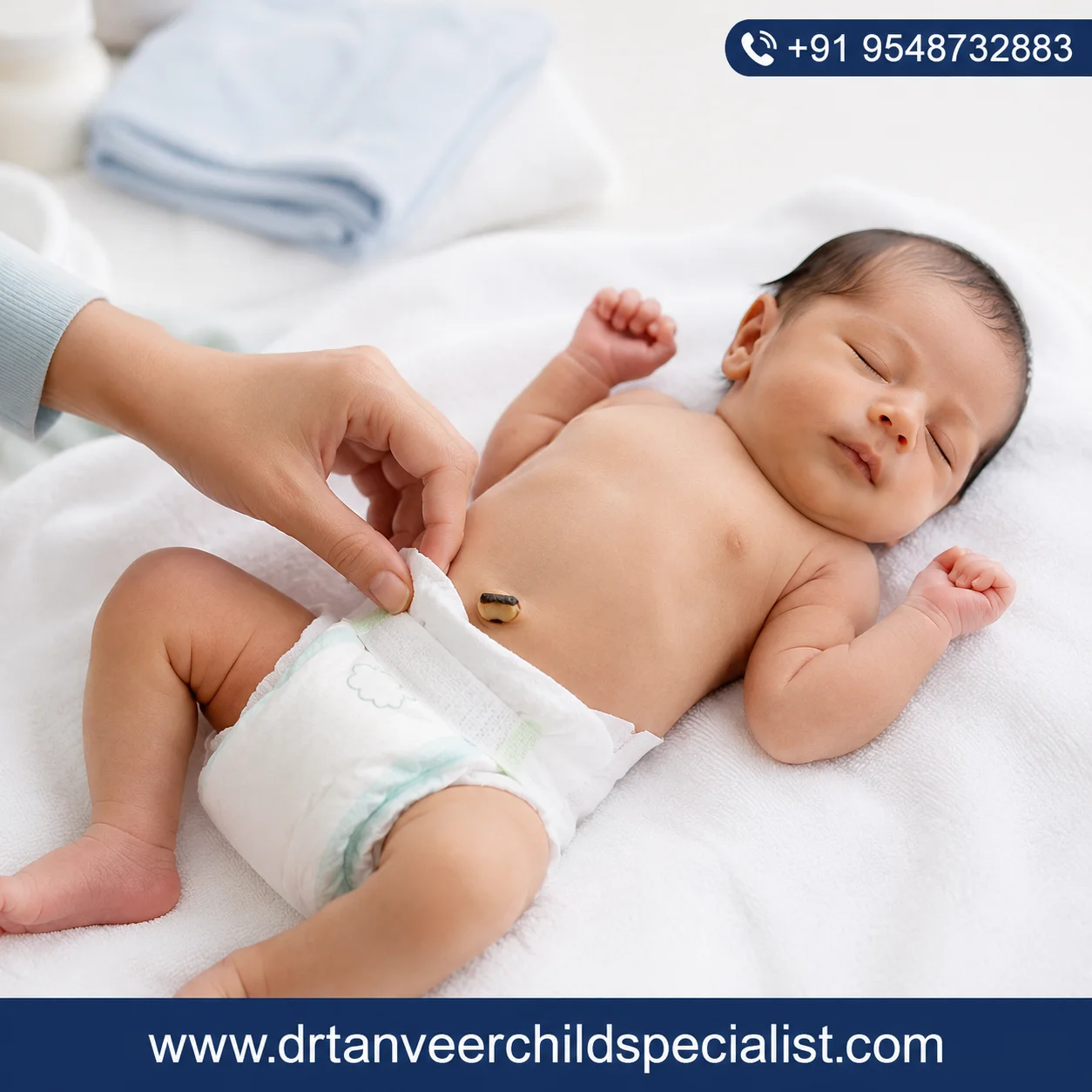 Umbilical Cord Care for Newborn Babies